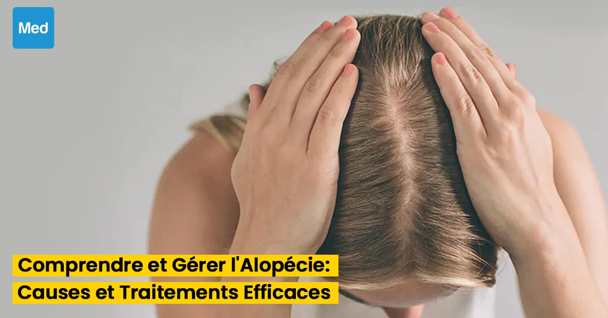 Comprendre et Gérer l'Alopécie : Causes et Traitements Efficaces